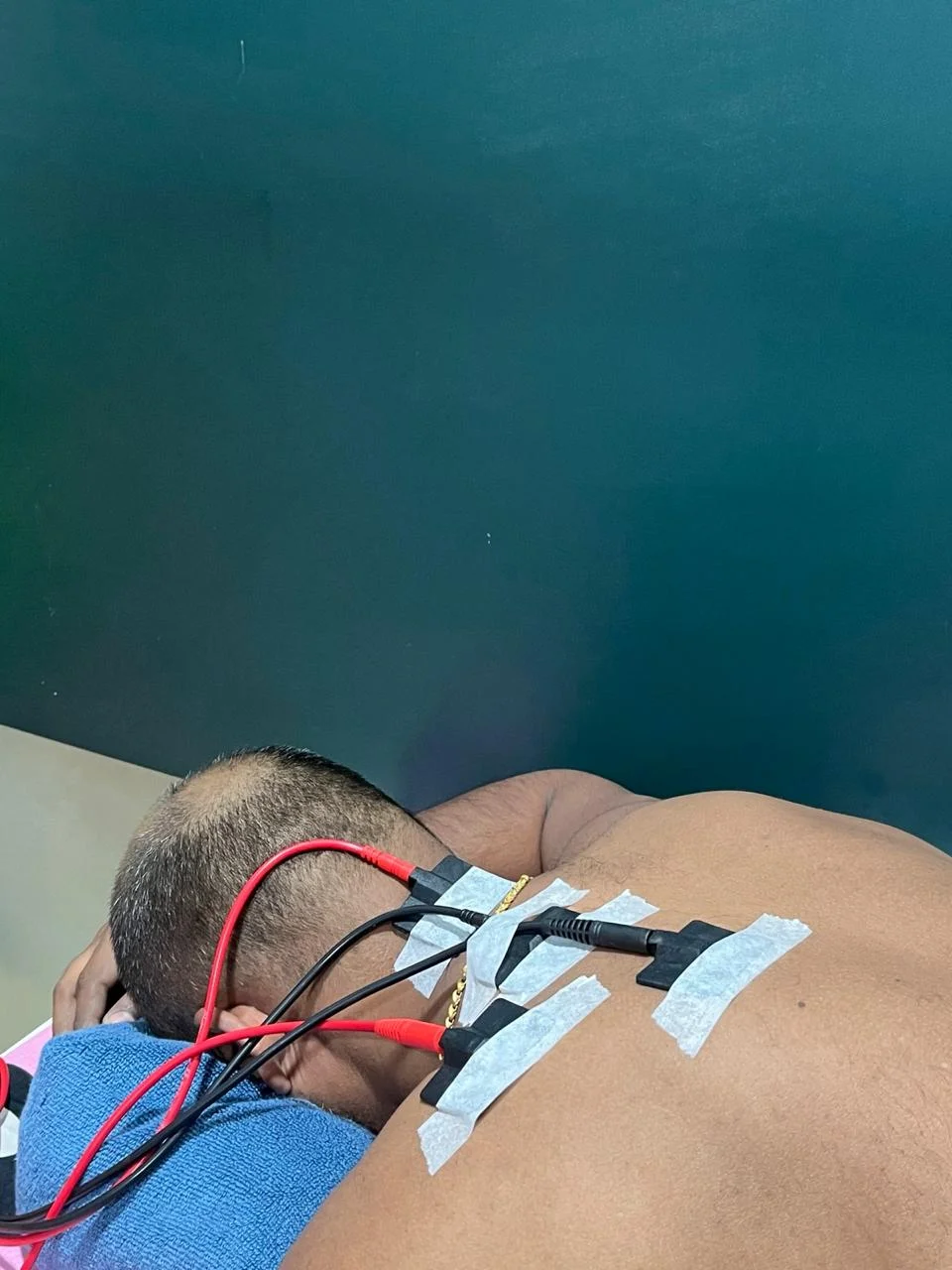Cupping & Electrotherapy
